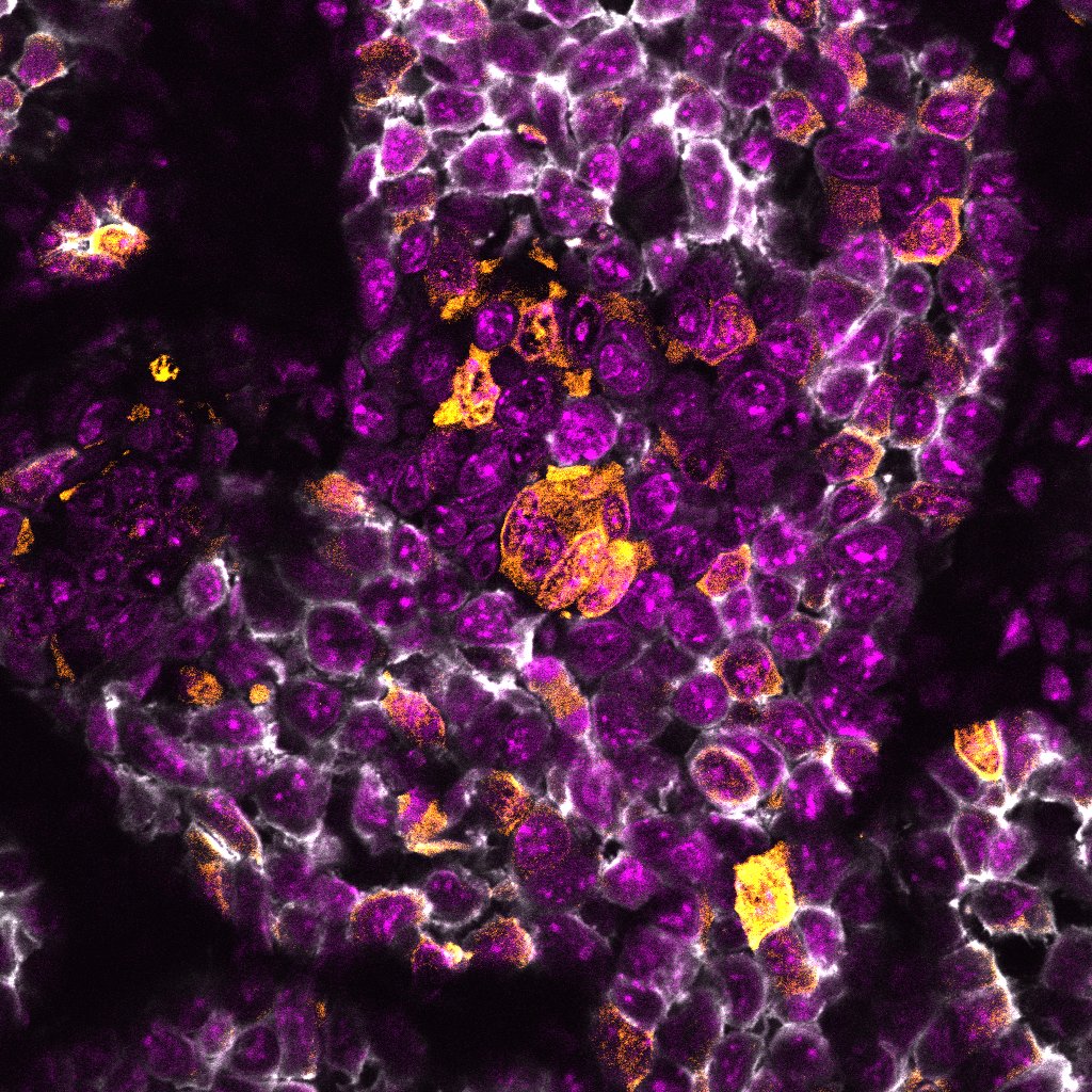 Roarty basal-like-tnbc – Roarty Lab @ BCM