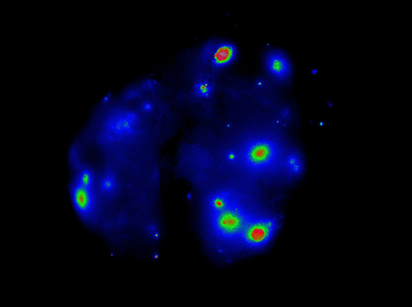 Roarty lung-metastases – Roarty Lab @ BCM