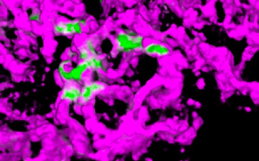 Roarty lungmetastasisvasculature – Roarty Lab @ BCM